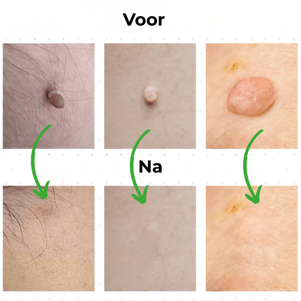 Cavorria ClearSkin™ – De #1 oplossing waarmee je huid weer straalt.