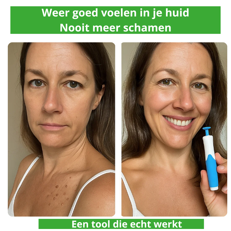 Cavorria ClearSkin™ – De #1 oplossing waarmee je huid weer straalt.