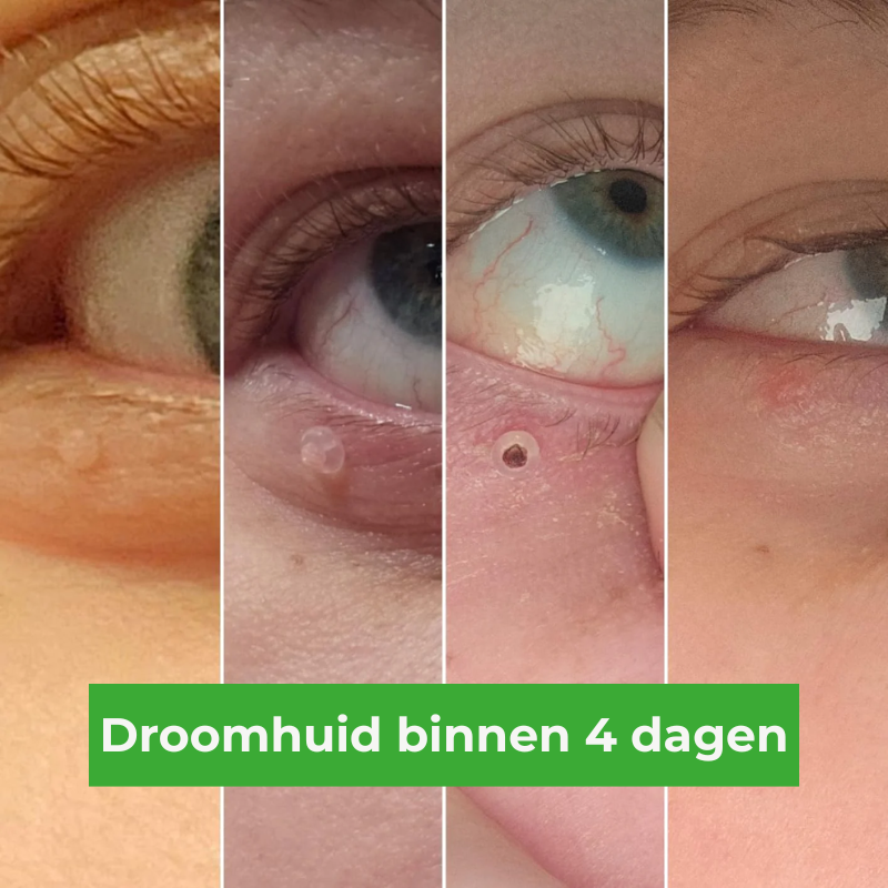 Cavorria ClearSkin™ – De #1 oplossing waarmee je huid weer straalt.